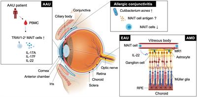 Functions of mucosal associated invariant T cells in eye diseases